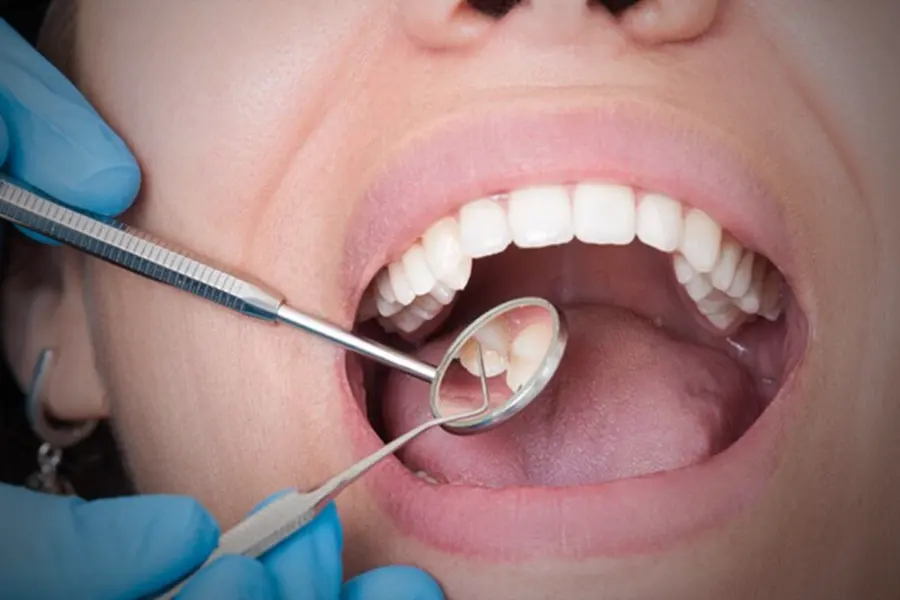 Bachelor of Dental Surgery (BDS )